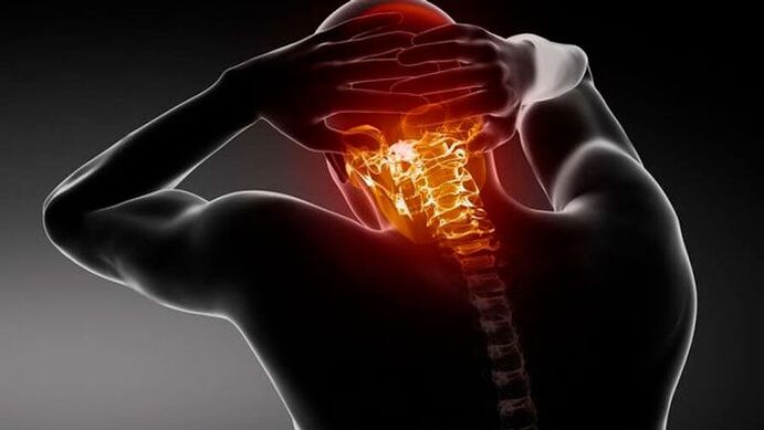 bolesti hlavy s cervikální osteochondrózou