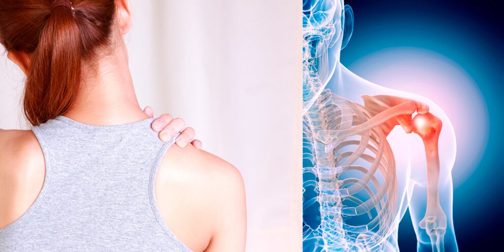 Rozvoj artrózy ramene postupně vede k neustálé bolesti