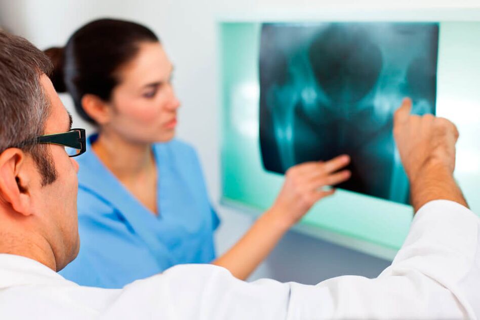Revmatolog nebo traumatolog diagnostikuje bolest v kyčelním kloubu. 