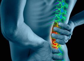 Příčiny a příznaky osteochondrosy